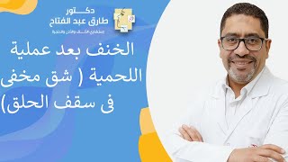 أسباب الخنف بعد عملية اللحمية (   شق مخفى فى سقف الحلق)