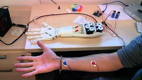 Roujin Project - InMoov Arm  and EMG 1