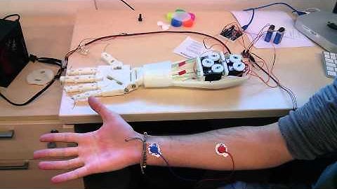 Roujin Project - InMoov Arm  and EMG 1