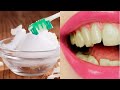 10 forma de blanquear tus dientes/ Dile adiós a los dientes amarillos con estos trucos