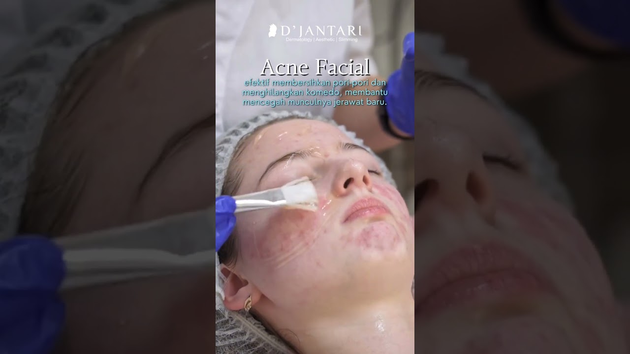 D’Jantari Acne Clear