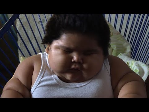 Mexique Luisito Un Bebe De 28 Kg En Attente D Un Diagnostic Youtube