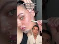 Dermaplaning Top Oder Flop Dr Med Alice Martin Shorts 