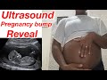 Ultrasound visit Baby Bump Reveal || Seeing my Baby Pregnancy update