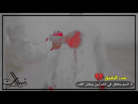 طعنة غدر منها على الجرح غنية جرح القرايب موت ياجارحينه