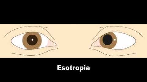 Corneal Light Reflections