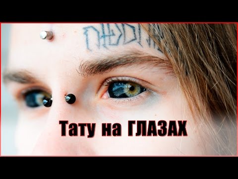 Video: Belchata - Albinoer Blir Tatt Under Vergemål - Alternativt Syn