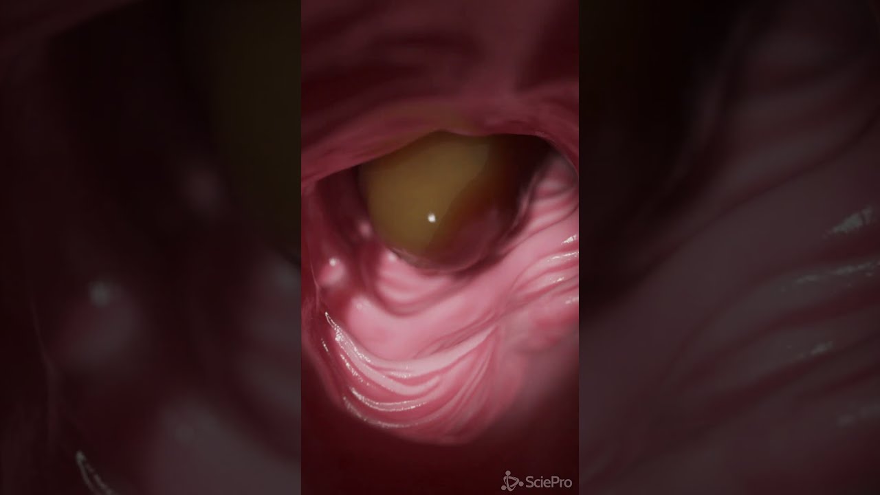 How Your Food Passes The Colon Anatomy Meded 3dmodel