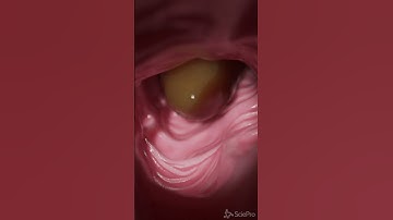 How your food passes the colon #anatomy #meded #3dmodel