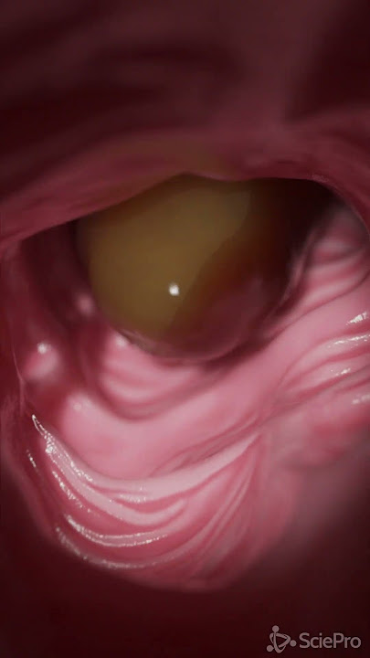 How your food passes the colon #anatomy #meded #3dmodel