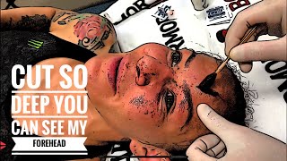 Cris Cyborg UFC 240 MMA Cut so deep you can see her skull