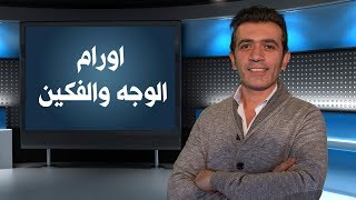 اورام الوجه والفكين- دكتور حاتم مطر أخصائي جراحة الوجة والفكين