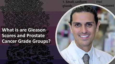 What are Prostate Cancer Gleason Scores and Grade ...