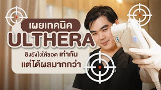 เผยเทคนิค Ulthera ทำยังไงให้ได้ผลลัพธ์มากที่สุด เจ็บน้อยลง หน้าเรียวนาน ต้องดู!!