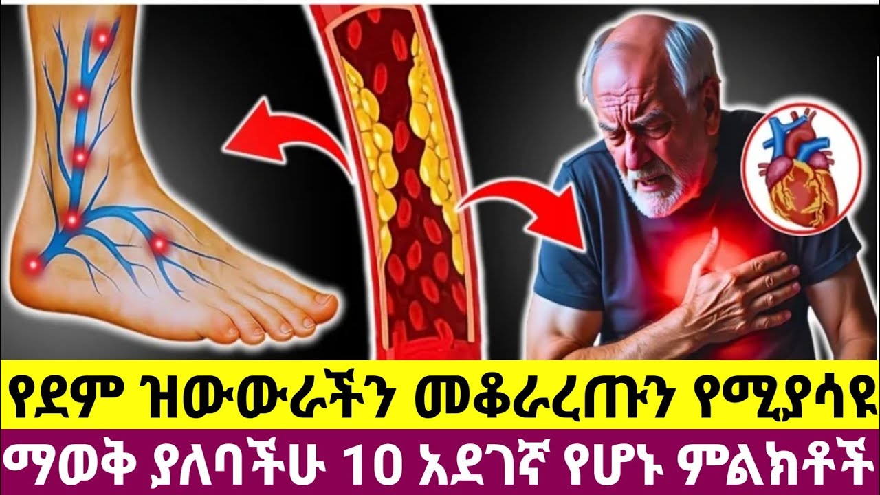 የደም ዝውውራችን ደካማ እንደሆነ የሚያሳዩ 10 አደገኛ ምልክቶች | የግድ ማወቅ አለባችሁ