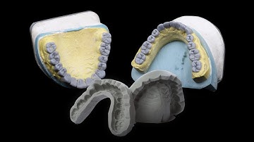 A guide to putty index making for test drive #FMR #Smiledesign
