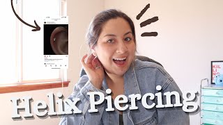 My Helix Experience|Pain level, cost, worth it?