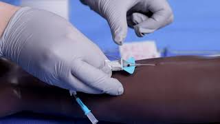 Insertion of a Nexiva Peripheral Intravenous IV Catheter in the Adult Population