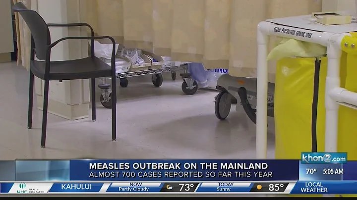 President Trump is now urging vaccinations to prevent the spread of measles