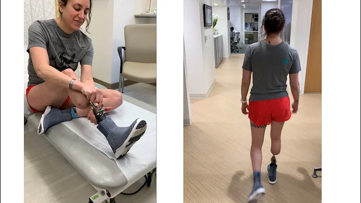 Dr. Rozbruch discusses Osseointegration in the tibia