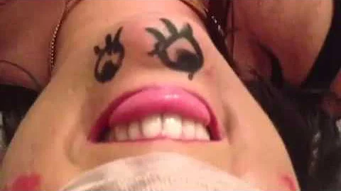 Nicola chin face