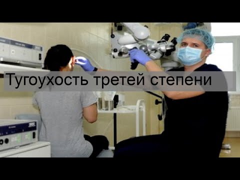 Тугоухость третей степени