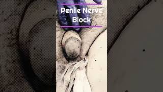 Penile Nerve Block