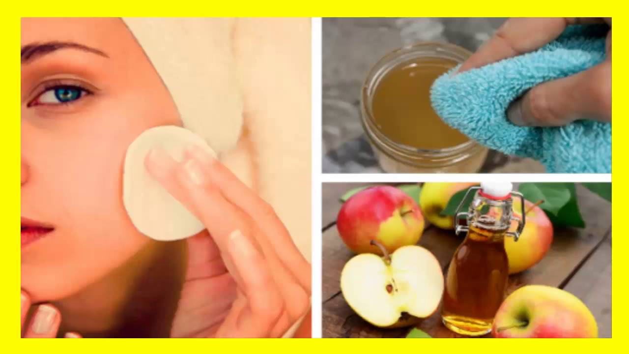 Протирание лица яблочным уксусом. Яблочный уксус от пигментных пятен. Примочки на лицо. Протирать кожу уксусом. Яблочный уксус для кожи лица.