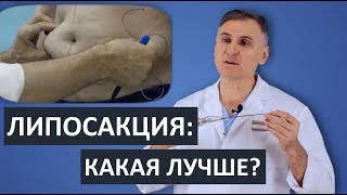 🔥ЛИПОСАКЦИЯ: КЛАСИЧЕСКАЯ, УЛЬТРАЗВУКОВАЯ, ЛАЗЕРНАЯ, ВОДНАЯ. ЧТО ЛУЧШЕ? 🔥ЛИПОСАКЦИЯ: КЛАСИЧЕСКАЯ, УЛЬТРАЗВУКОВАЯ, ЛАЗЕРНАЯ, ВОДНАЯ. ЧТО ЛУЧШЕ?