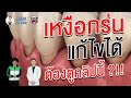 ปัญหาเหงือกร่น แก้ไขได้ ต้องดูคลิปนี้ ?!! | ลิ้นติดโปร By หมอโชค