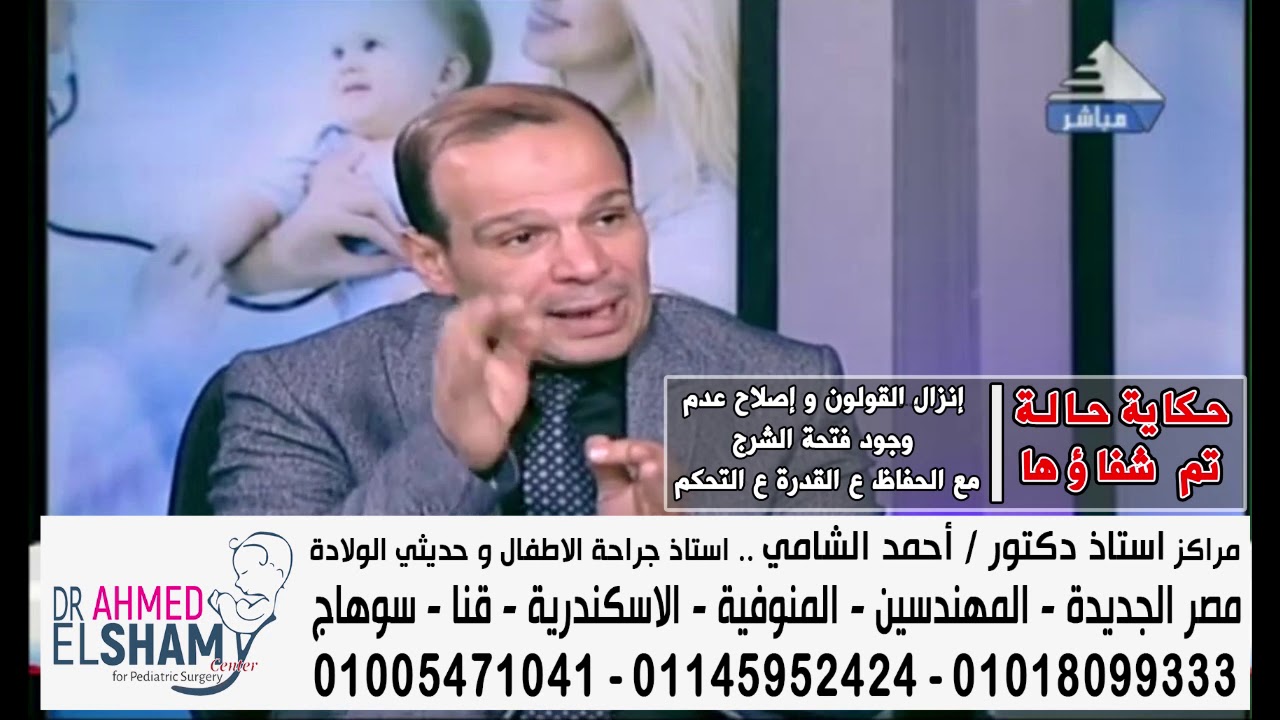 إنزال القولون و إصلاح عدم وجود فتحة الشرج مع الحفاظ ع القدرة ع التحكم ا.د/احمد الشامي جراحة الاطفال