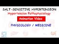 Salt sensitive hypertension  hypertension pathophysiology  medicine  physiology  heart series 8