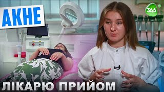 АКНЕ! ВСЕ ЩО ВАМ ПОТРІБНО ЗНАТИ ПРО ПРИЧИНИ СИМПТОМИ ТА ЛІКУВАННЯ АКНЕ.