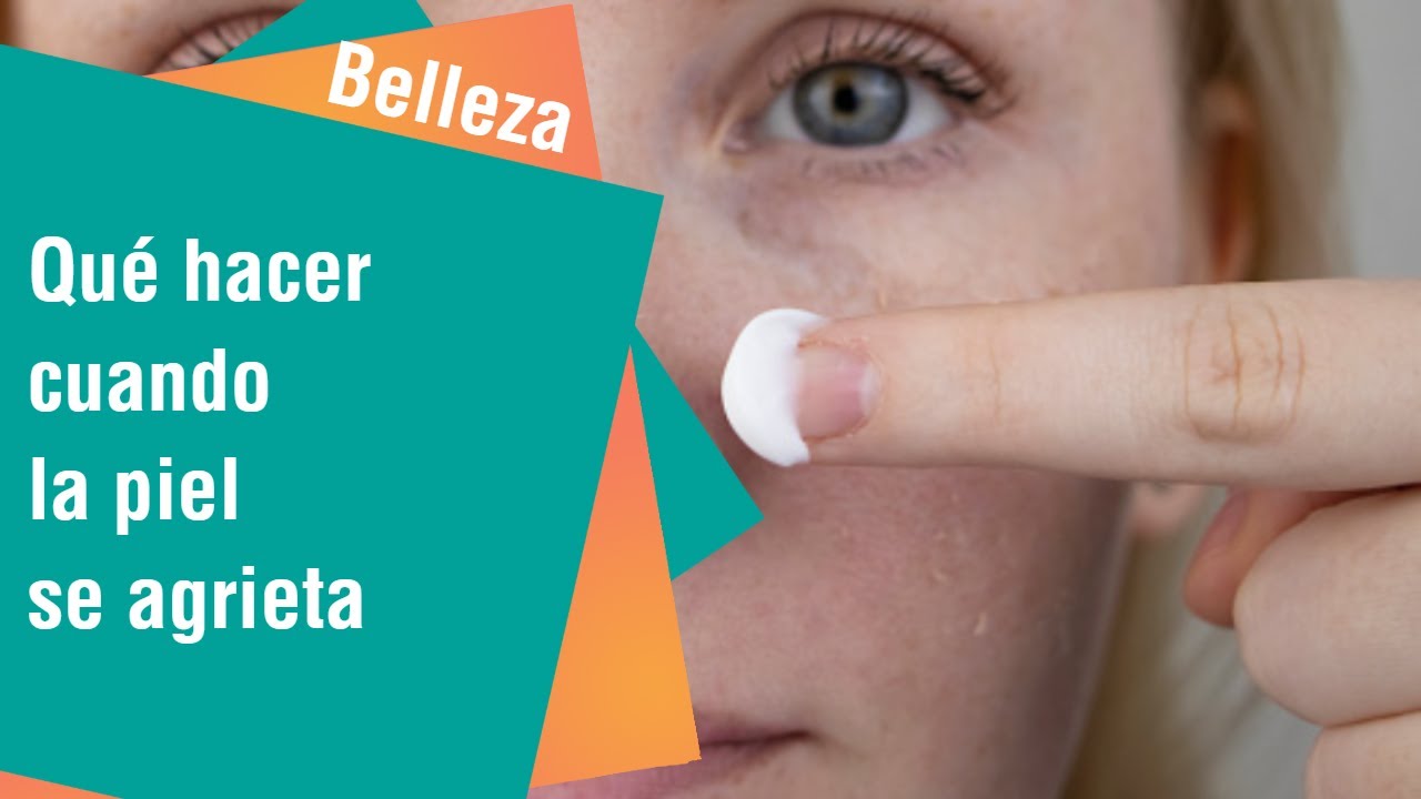 Qu Hacer Cuando La Piel Se Agrieta Belleza YouTube