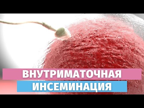 Видео: Какво представлява BDP на ултразвук по време на бременност: описание на индикатора, норма, интерпретация на резултатите от изследването