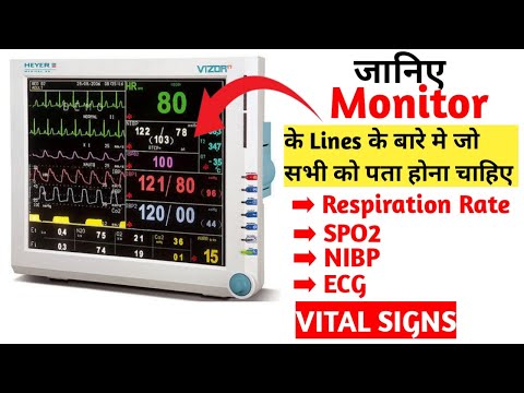 ICU MONITOR READINGS EXPLAINED | VITAL SIGNS | WHAT DO ICU MONITORS SHOW