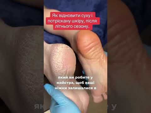 Комплекс для загоєння тріщин та догляду за п'ятами, видео 1