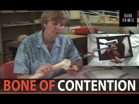 EXHIBIT A: BONE OF CONTENTION
