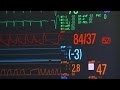 Prototype Brain Monitoring Computer | Bang Goes The Theory | Earth Science