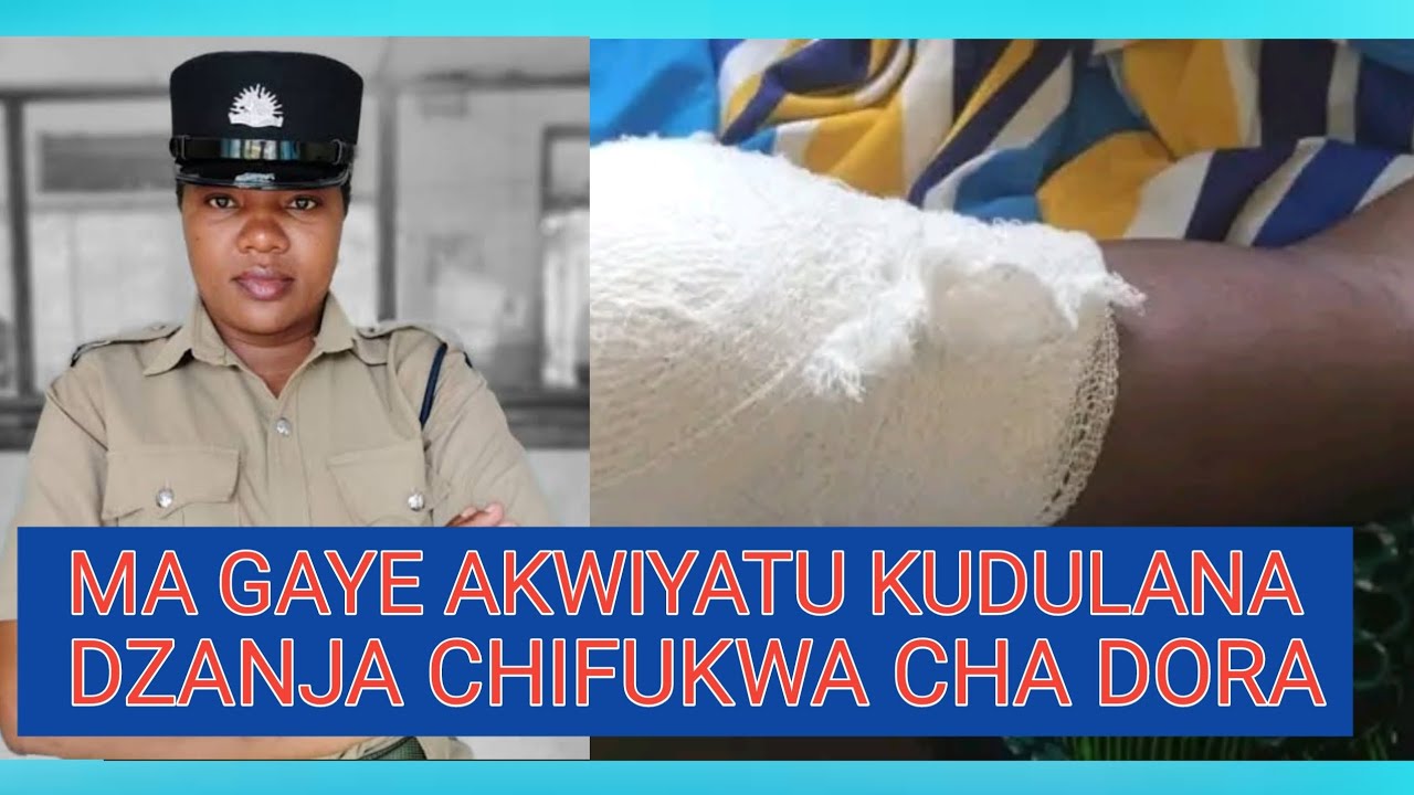 POLICE YALOWELERAPO KUSAKA ODULA DZANJA NZAKE ATAMUPONDA NDARAMA KU KALONGA