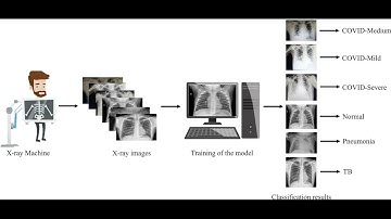 X ray based diagnosis using deep learning and CGAN