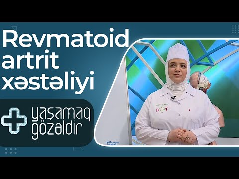 Revmatoid artrit xəstəliyi - Kamilə Yusifova - 02.05.2022 - Yaşamaq Gözəldir