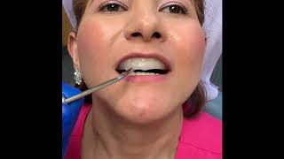 Temporary Retainers made easy!