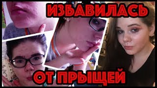 ИЗБАВИЛАСЬ ОТ ПРЫЩЕЙ! | Очищаю мысли, компьютер и лицо :)