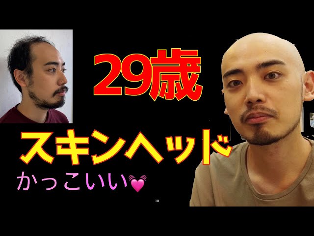 スキンヘッド様 29歳スキンヘッド 人生が変わりました！ - YouTube