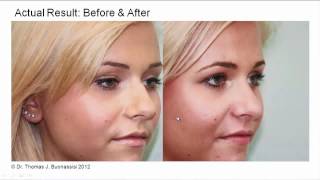 Famous Computer Imaging Reliability & Predicting Results | Dr. Buonassisi, 8 West Clinic in Vancouver BC Profile