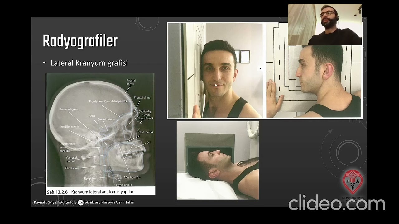 Radyolojik anatomi 3 ÜÇ - Radyografi anatomisi