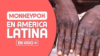 La Verdad Médica Sobre la Viruela del Mono (Monkeypox 2022)