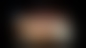 Robotic Left Lateral Hepatectomy