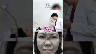 Bác sĩ Tú Dung MỔ KHẨN CẤP cứu U50 mũi CHÁY XÉM vì tin lời THẦY PHONG THUỶ THÁI LAN thẩm mỹ đổi vận
